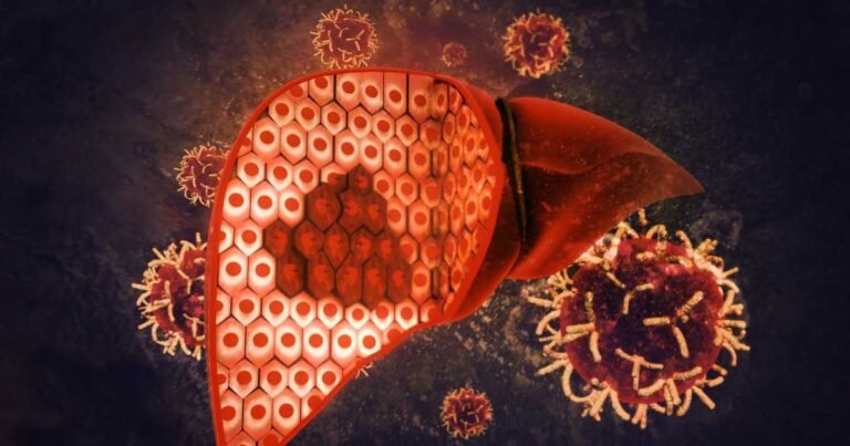 Fatty Liver Disease