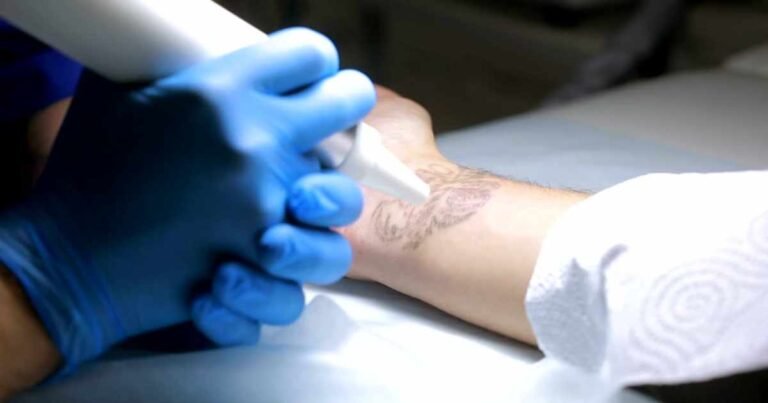 Tattoo Allergies